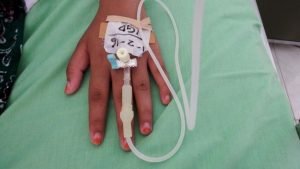 Apakah Pembuluh Darah Pecah Ditanggung Bpjs Kesehatan?