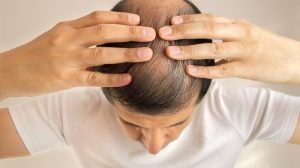 Studi: Masakan Bagus Bikin Pria Cepat Gundul