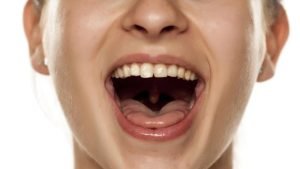 7 Penyebab Rahang Berbunyi Ketika Membuka Mulut, Bisa Jadi Ada Tumor